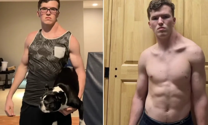 Chỉ tập một bên vai suốt 300 ngày, chàng trai 19 tuổi nhận cảnh báo từ bác sĩ