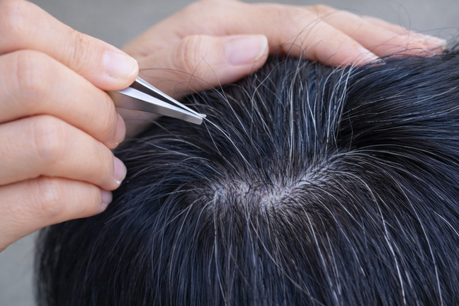 Một thói quen phổ biến ai bị tóc bạc cũng làm khiến tóc càng bạc, càng thưa