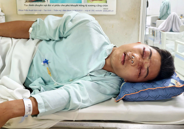 Chàng trai 19 tuổi gặp tai nạn khi bốc gỗ, 20 triệu vay mượn không đủ viện phí