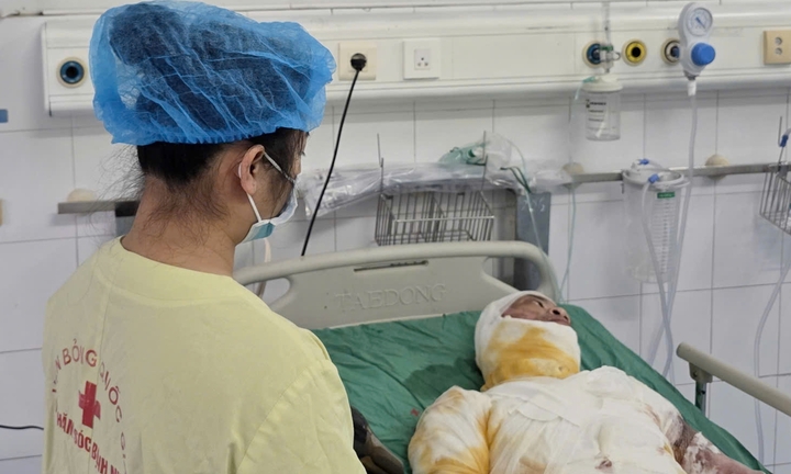 Chồng tâm thần bị lửa trùm kín thân, vợ bóc gỗ thuê bất lực vì cạn tiền