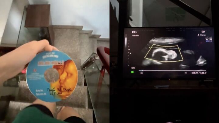 Clip siêu âm thai vừa tìm thấy và tâm thư người con làm dân mạng 'cay sống mũi'