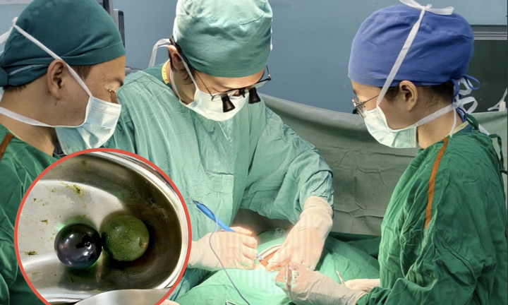 Bé gái 18 tháng tuổi nguy kịch, ruột tắc nghẽn vì nuốt hạt nở đồ chơi