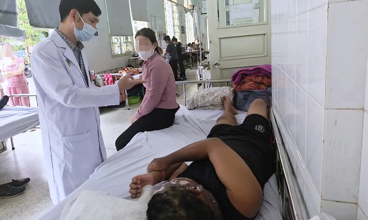 Cảnh báo tai nạn do pháo nổ dịp cận Tết