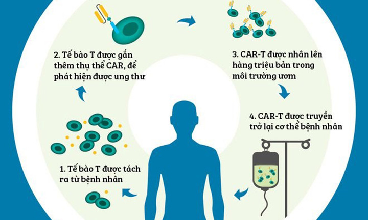 Liệu pháp CAR-T được dùng điều trị ung thư máu là gì?