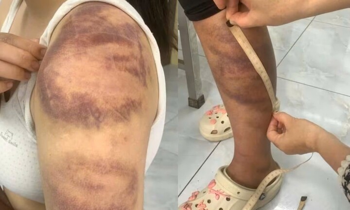 Tạm giữ gã chồng 4 lần đánh đập vợ bầu và con gái 13 tuổi