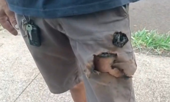 Điện thoại phát nổ cứu sống một người khỏi nanh vuốt chó dữ