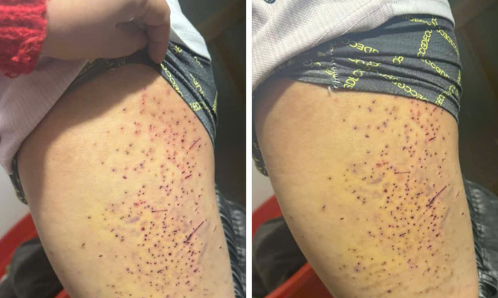 Xác minh thông tin học sinh nghi bị bạn dùng vật nhọn gây thương tích