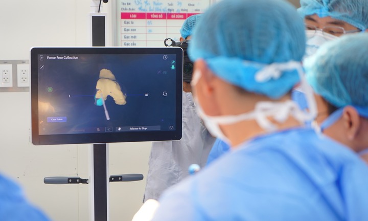 Thay khớp gối bằng robot tại Việt Nam: Chi phí bằng 1/5 nước ngoài, đi lại sau 24 giờ