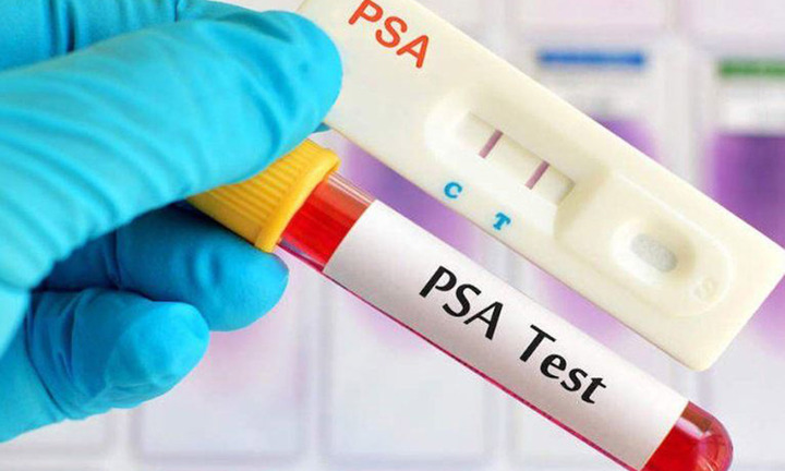 1 ngày 3 ca ung thư tuyến tiền liệt: Sai lầm khiến quý ông lỡ 'thời điểm vàng'