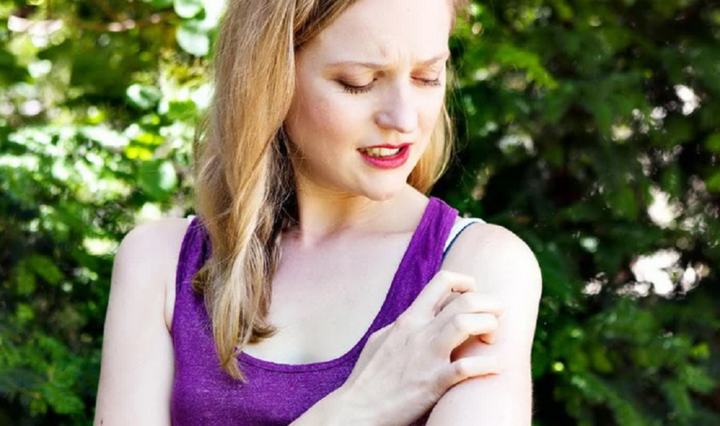 Câu nói 'người xinh đẹp thường thu hút muỗi' có hoàn toàn vô lý?