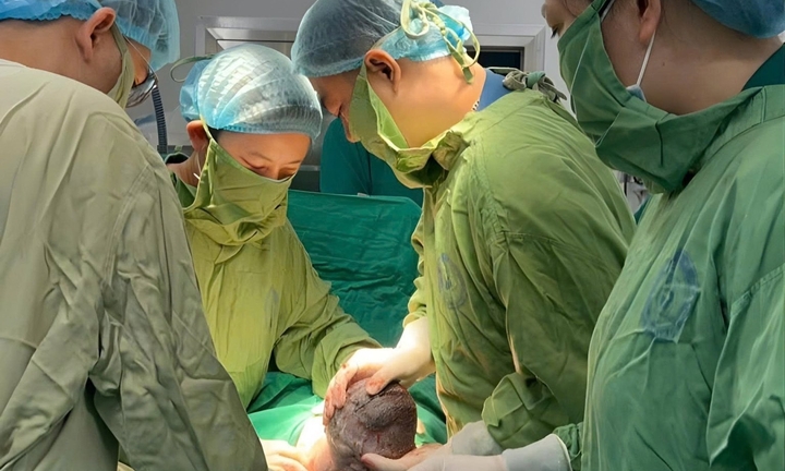  Em bé mang 'đôi cánh tí hon' chào đời diệu kỳ sau ca can thiệp từ bụng mẹ