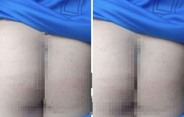 Tạm dừng đứng lớp 2 giáo viên vụ phụ huynh vào trường đánh học sinh