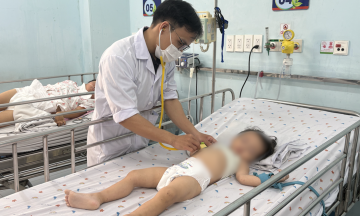 Chủng EV71 khiến ca tay chân miệng nặng tăng, TP.HCM dự phòng kịch bản quá tải