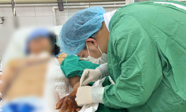 Vi khuẩn 'ăn mòn' bàn tay sau mũi tiêm, người phụ nữ suýt mất mạng