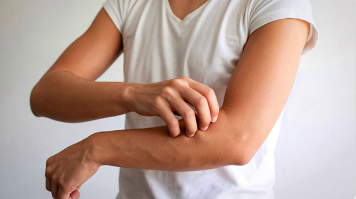 Cảnh báo: Ngứa da về đêm có thể là dấu hiệu sớm của bệnh suy thận