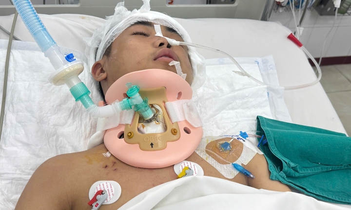 Mẹ chưa lành vết mổ vẫn nhịn ăn, cha xe ôm định bán 'cần câu cơm' cứu con