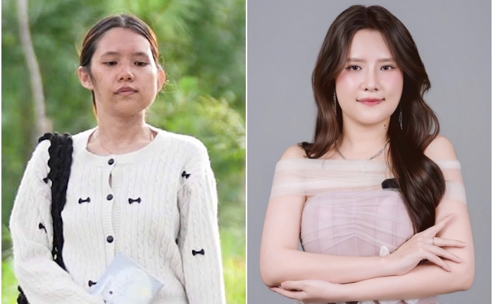 20 năm giấu mình sau khẩu trang và kỳ tích 'tái sinh' của cô gái Đà Lạt