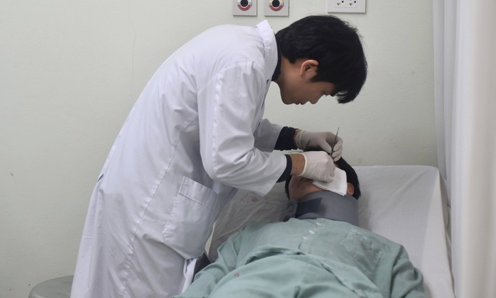  Tiêm filler ở spa, cô gái 24 tuổi nhập viện vì ổ áp xe sau 3 năm