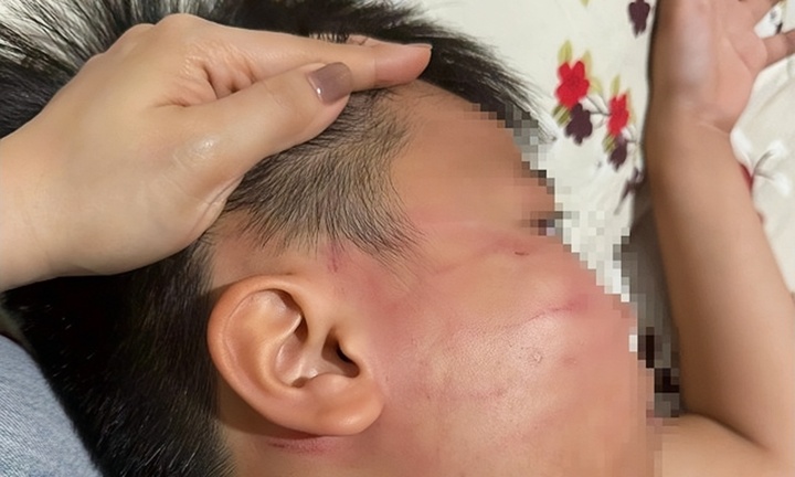 Thầy giáo Ấn Độ bị tố tát học sinh lớp 4 trong lớp học thêm ở Gia Lai