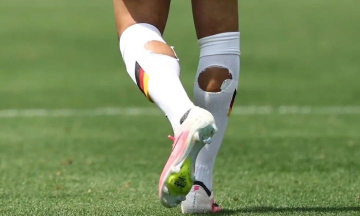 Warum wetteifern die Spieler der Weltmeisterschaft 2026 darum, wer zerrissene Socken tragen darf?