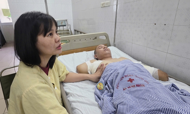 Sau mỗi giấc mê, người cha trẻ lại thấy mất đi một phần cơ thể vì điện cao thế