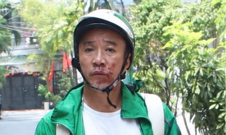 Bắt nghi phạm cướp giật tài sản, kéo lê nạn nhân ở TP.HCM