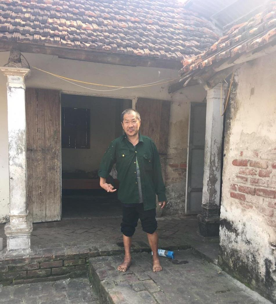 Xót xa người phụ nữ hỏng một mắt quanh năm mò cua bắt ốc nuôi chồng bại não - 1