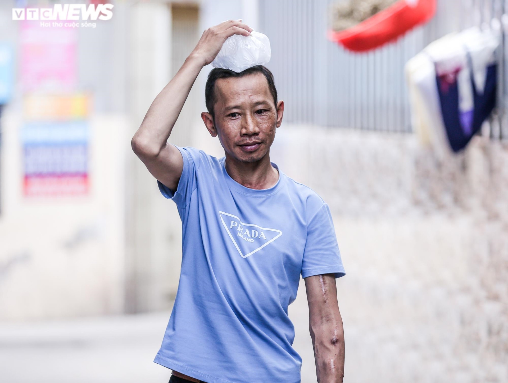 Xóm chạy thận oằn mình chống chọi nắng nóng đỉnh điểm, có điều hòa không dám bật - 11