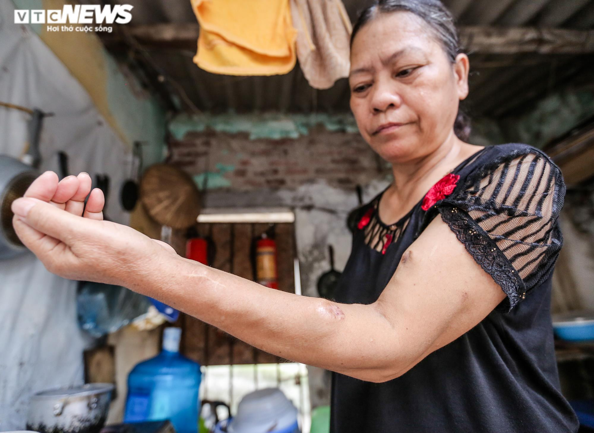 Xóm chạy thận oằn mình chống chọi nắng nóng đỉnh điểm, có điều hòa không dám bật - 16