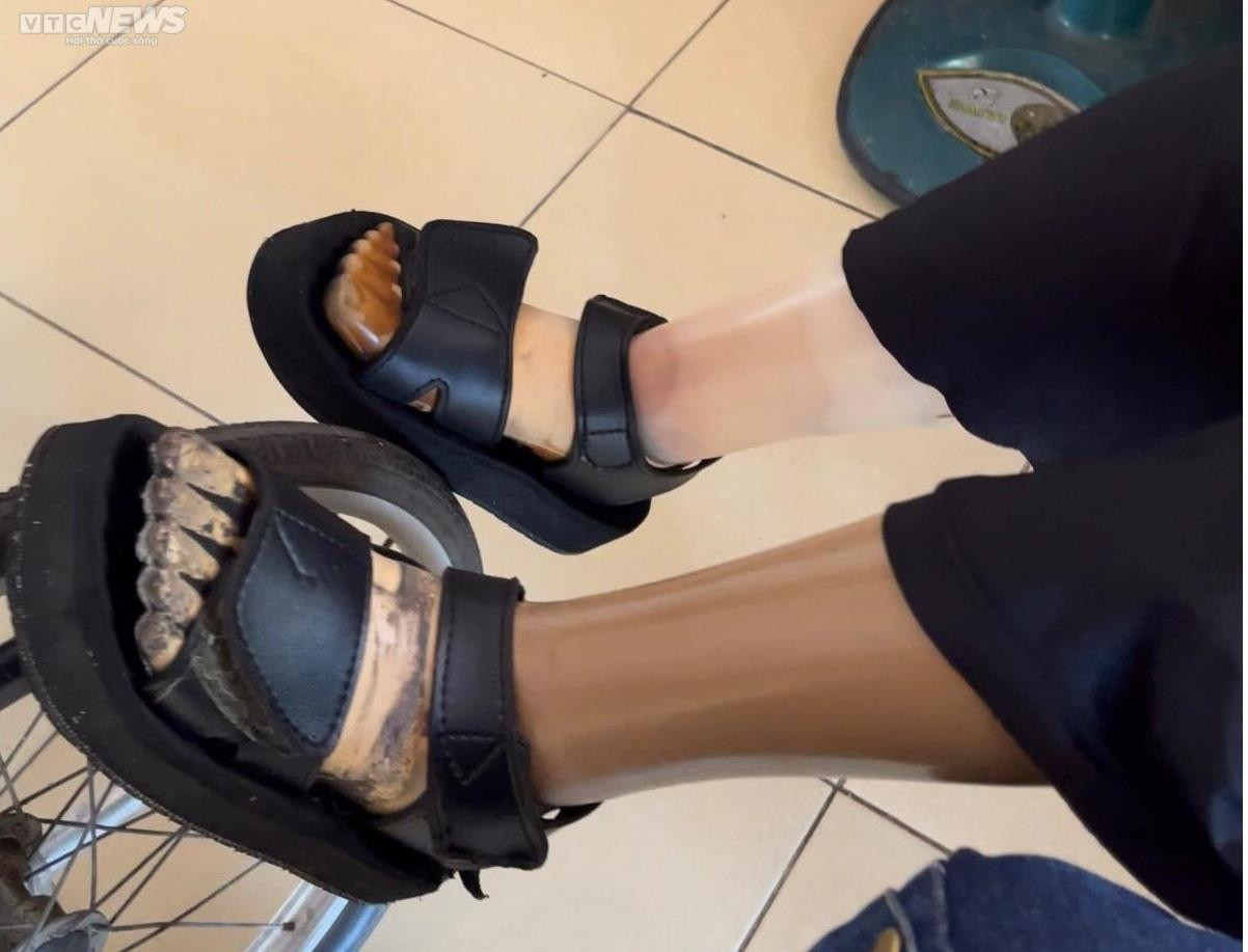 Đơn đặt hàng kỳ lạ cho những đôi chân bị ăn mòn theo năm tháng - 11