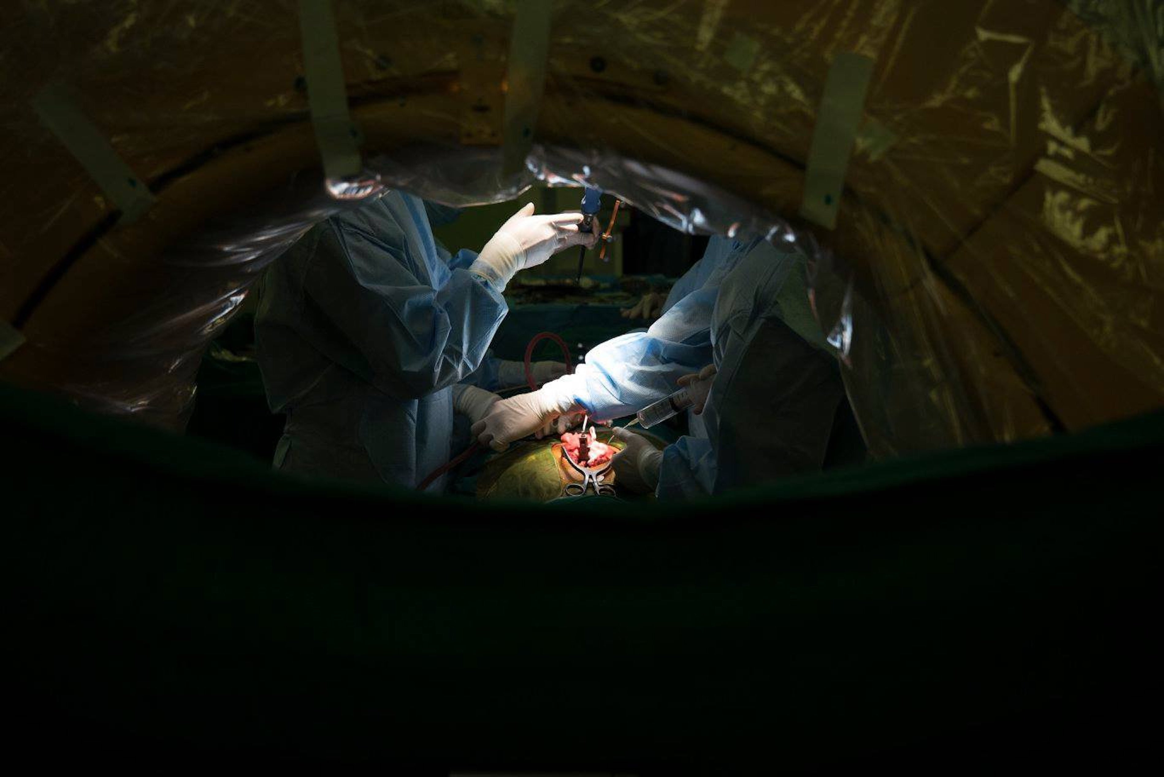 Bác sỹ trắng đêm chỉnh cột sống hình con rắn cho bé gái 13 tuổi - 12