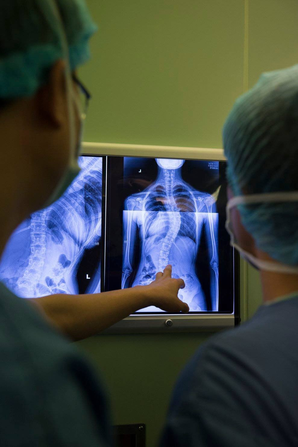 Bác sỹ trắng đêm chỉnh cột sống hình con rắn cho bé gái 13 tuổi - 3