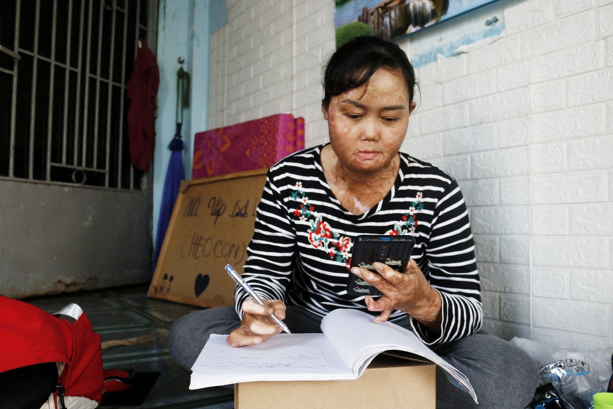 Sau hàng chục ca mổ, người phụ nữ bị chồng đổ xăng đốt bỏng 92% hiện ra sao? - 1