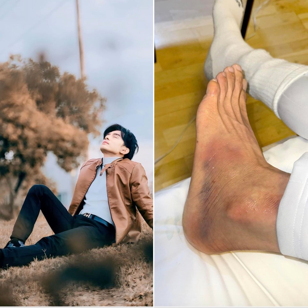 Sao Việt 26/4: Đan Trường bị ngã cầu thang, Midu đăng ảnh chồng sắp cưới - 1