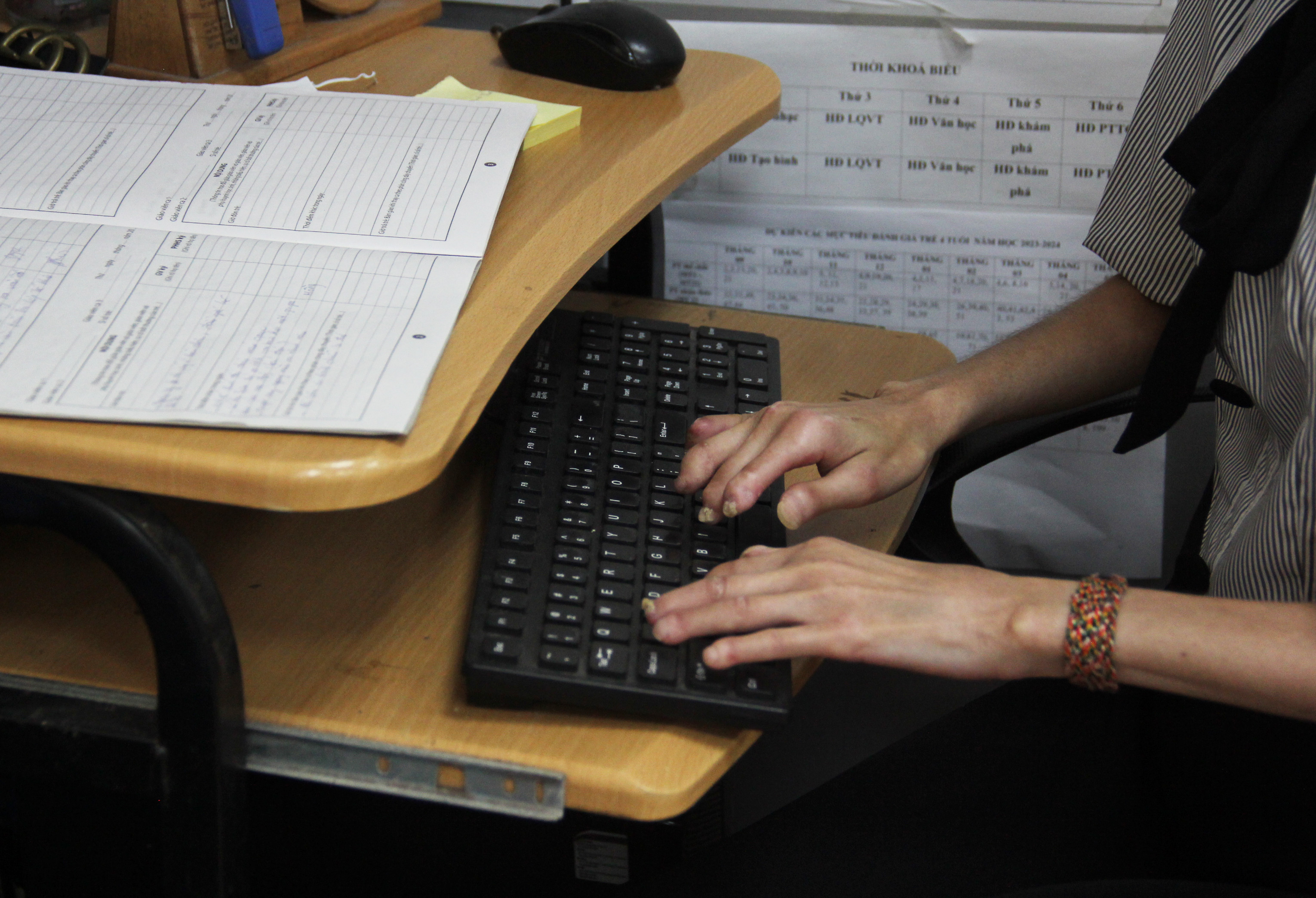 Cô giáo 'thiên nga hóa vịt xấu xí' do bệnh lạ trở thành TikToker triệu view - 12