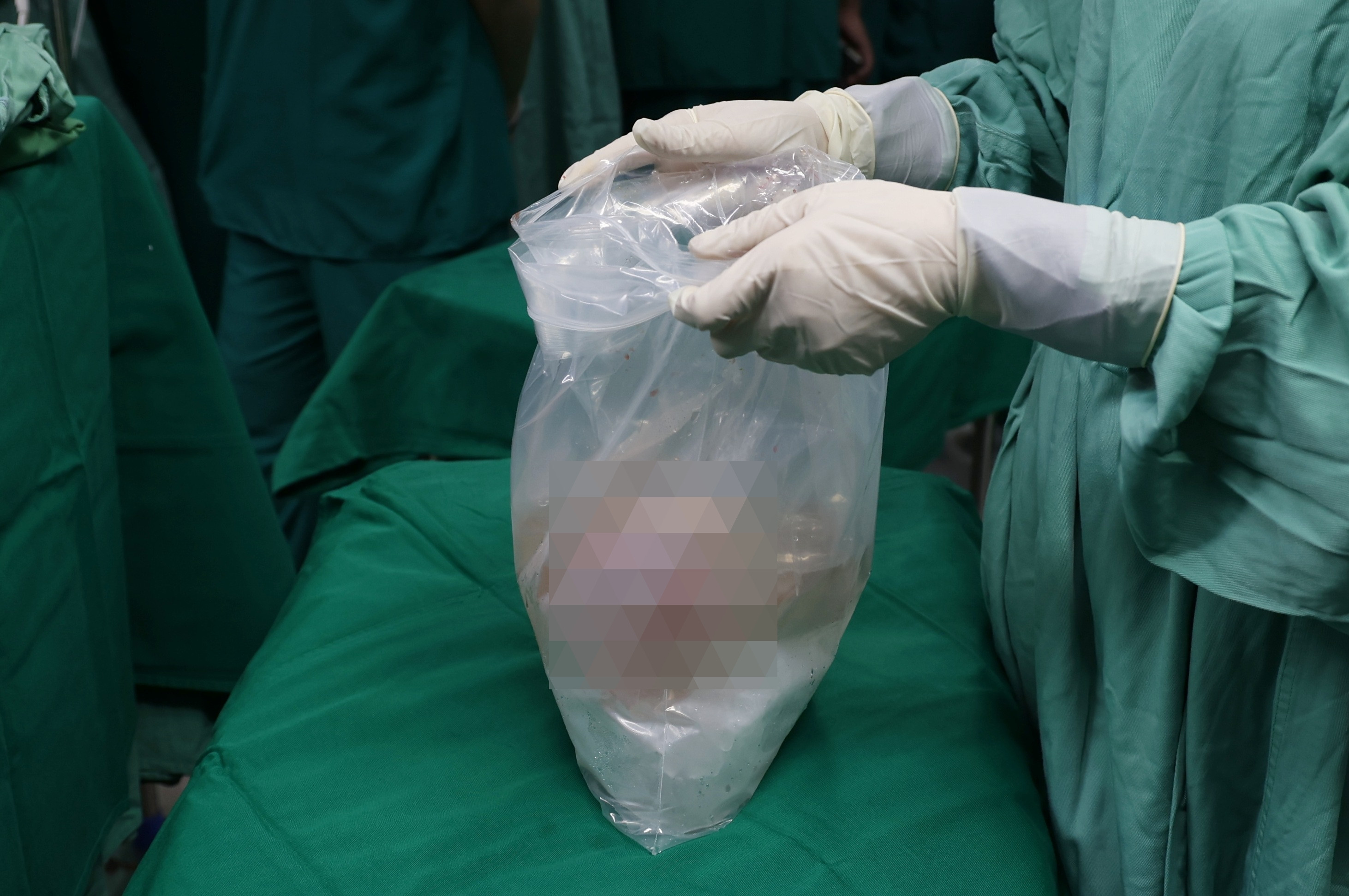 Ca đại phẫu của 60 y bác sĩ để người đàn ông chết não trao đi ‘món quà sự sống’ - 7