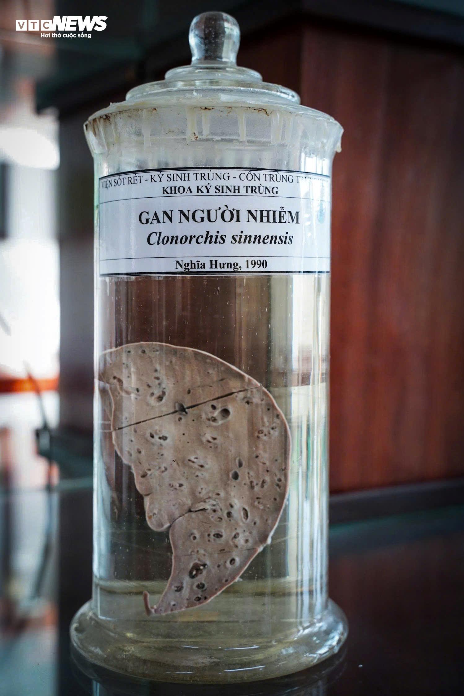 Bên trong bảo tàng lưu giữ những 'kẻ ký sinh' nguy hiểm nhất với con người - 6