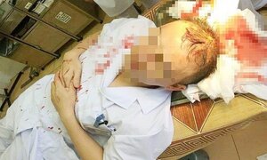 Hành hung, đánh trọng thương bác sĩ: Côn đồ hoành hành bất chấp đạo lý, nhân tính con người