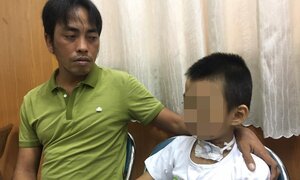 Cứu sống bé trai bị rơi từ độ cao 7m, rách nát vùng cổ