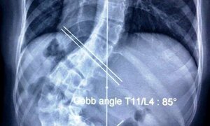 Nữ sinh viên bị bệnh lạ chưa từng được ghi nhận trong y văn thế giới