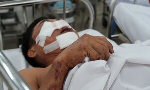 Lời kể của nạn nhân bị kẹp dính vào đầu xe sau tai nạn ở cao tốc Long Thành