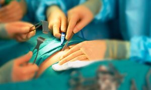 Sản phụ 22 tuổi bị vỡ tử cung suýt chết cả mẹ lẫn con