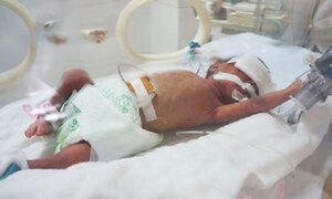 Tìm thấy vi khuẩn kháng thuốc ở ba bệnh nhi từng điều trị tại Bắc Ninh