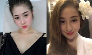Bất chấp đau đớn của dao kéo, 5 cô gái Việt lột xác thành mỹ nữ