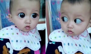 Ăn nhiều nho khi có thai, người phụ nữ choáng khi thấy con mình