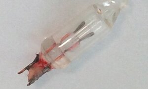 Bác sĩ phát hiện đèn trang trí trong phổi bé gái 14 tháng