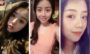 Sợ bệnh nhân chê cười, nữ y tá béo xấu xí lột xác ngoạn mục thành 'nữ thần'