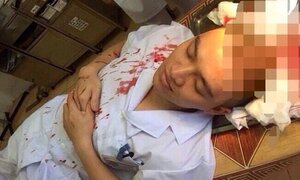 Bác sĩ lại bị đánh, máu nhuộm đỏ áo blouse, ngày Thầy thuốc năm nay buồn đến thế!