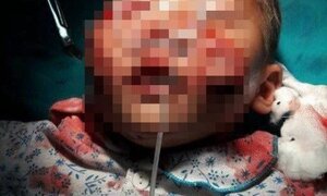 Chó cắn nát mặt bé trai 3 tuổi