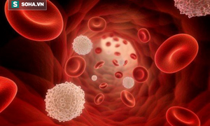 Bác sĩ Viện Huyết học và Truyền máu TƯ chỉ ra 6 dấu hiệu sớm của bệnh ung thư máu